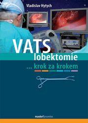 VATS lobektomie