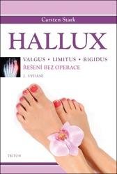 Hallux