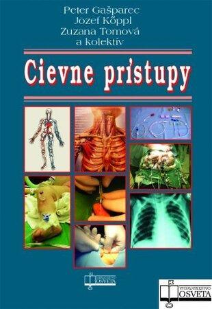 Cievne prístupy - 978-80-8063-309-7
