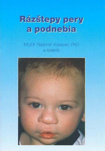 Rázštepy pery a podnebia - 80-8065-008-X