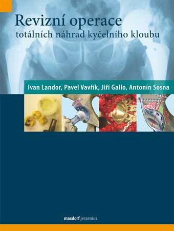 Revizní operace totálních náhrad kyčelního kloubu - 978-80-7345-254-4