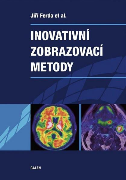 Inovativní zobrazovací metody - 978-80-7492-186-5