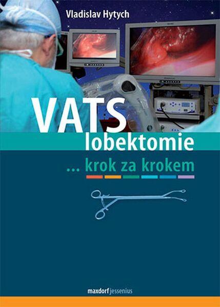 VATS lobektomie - 978-80-7345-449-4