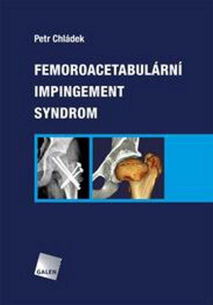Femoroacetabulární impingement syndrom - 978-80-7492-251-0