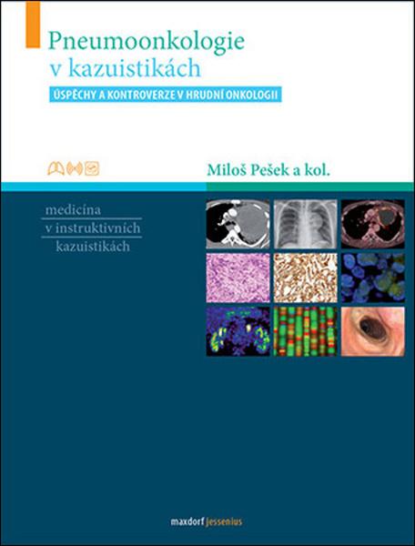 Pneumoonkologie v kazuistikách - 978-80-7345-588-0