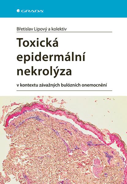 Toxická epidermální nekrolýza - 9788027138548