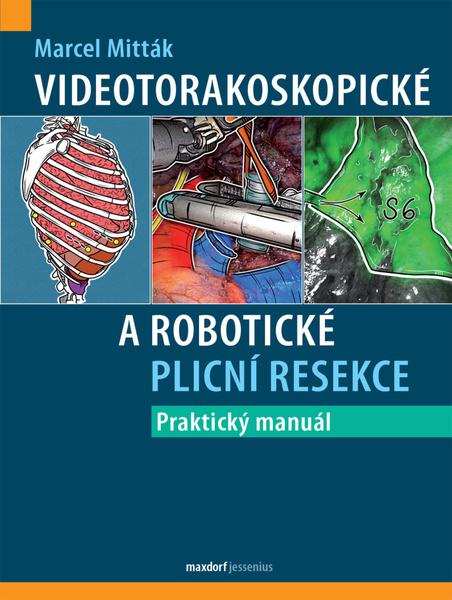 Videotorakoskopické a robotické plicní resekce - 9788073458072
