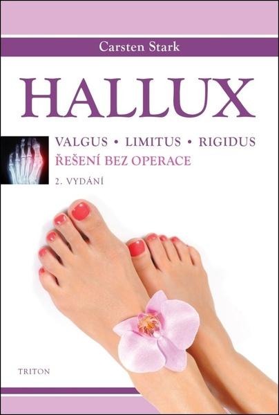 Hallux - 9788076844551