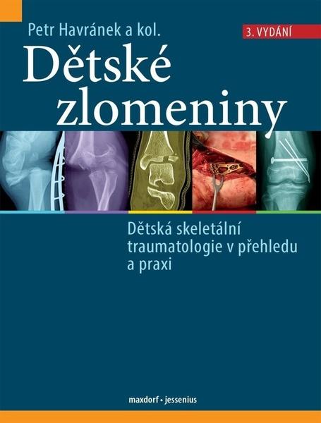 Dětské zlomeniny - 9788073458416